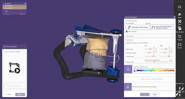 Virtual Articulator Transfer Minimizes Time for Jaw Adjustment